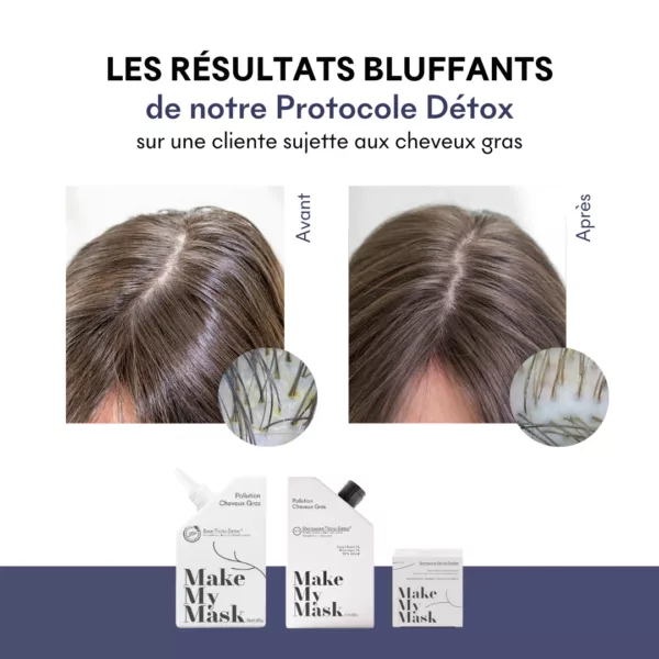 Shampoing cheveux gras Tricho-Détox pH5 – Image 3