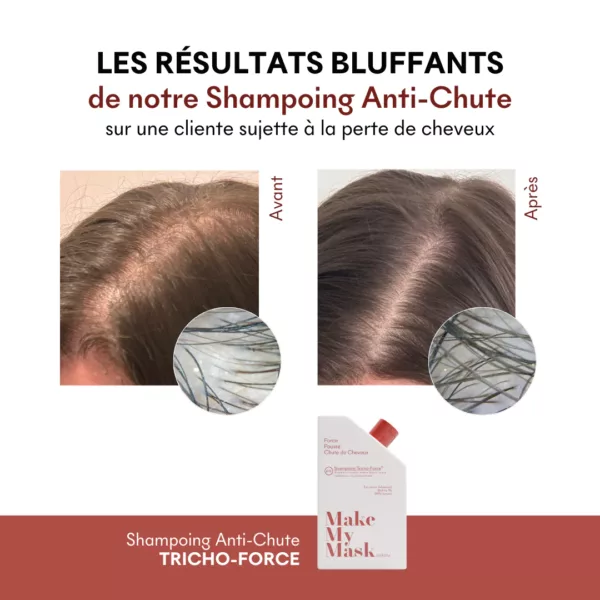 Shampoing Anti-Chute Tricho-Force pH5 – Image 3