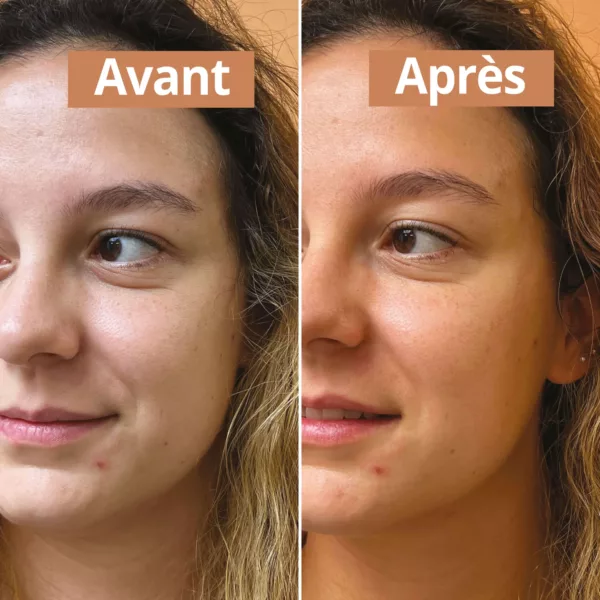 Sérum visage bonne mine - Version 1 – Image 2